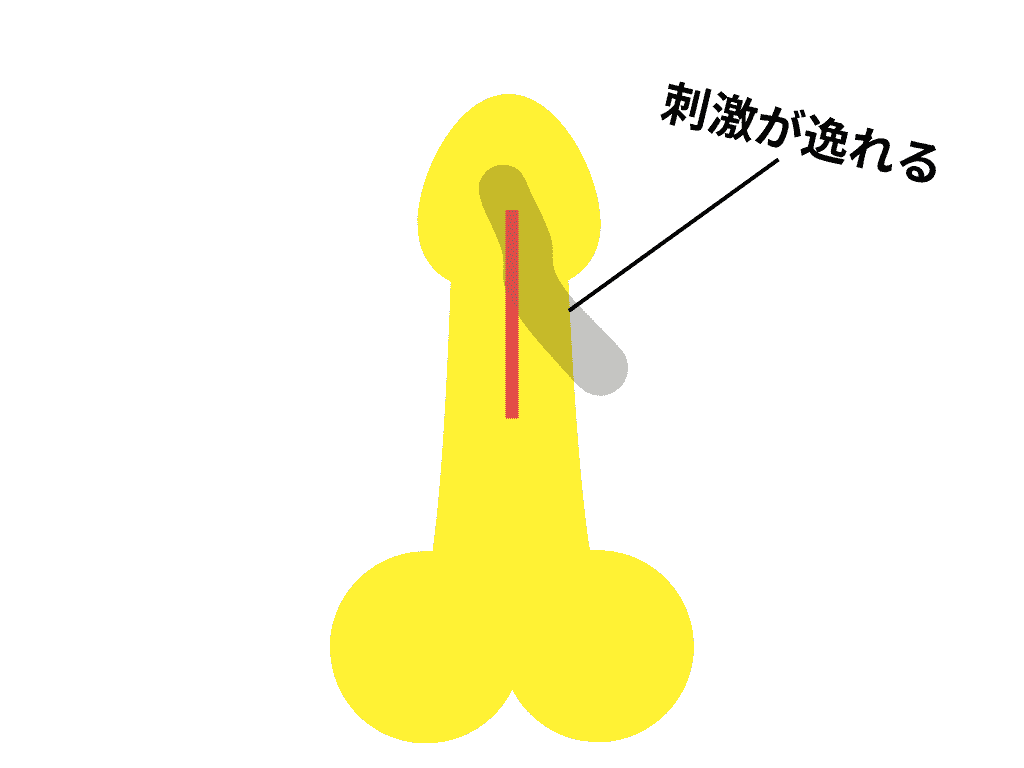 刺激會從龜頭繫帶偏移