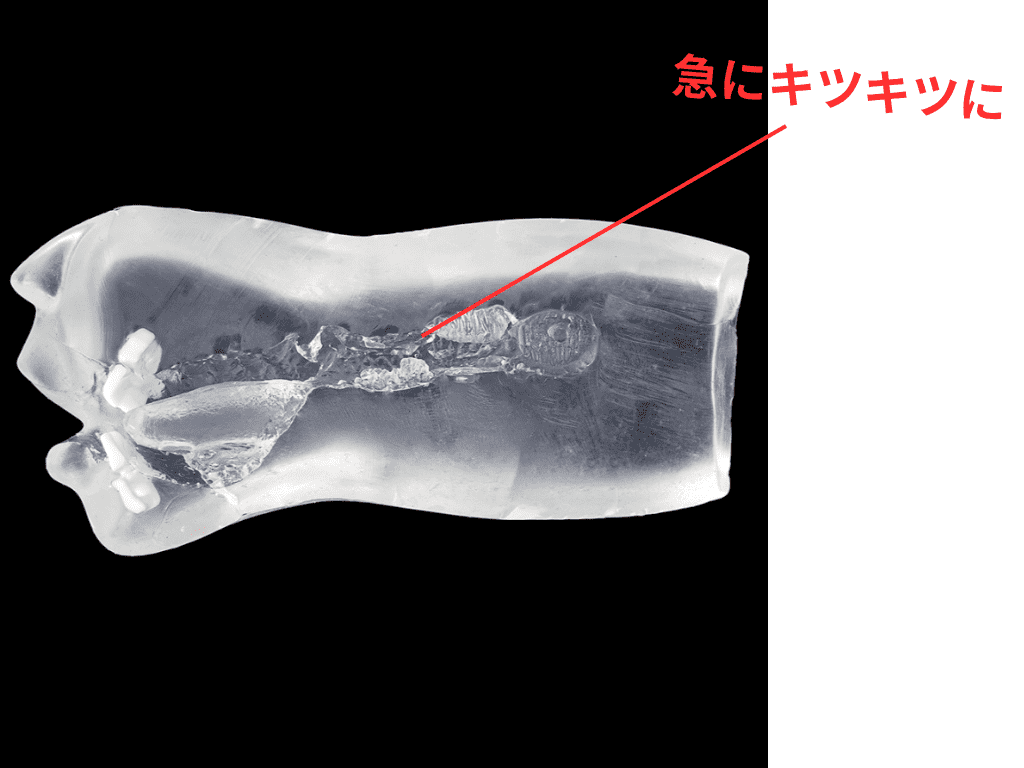 真実の口 レントゲン的喉嚨深處很緊