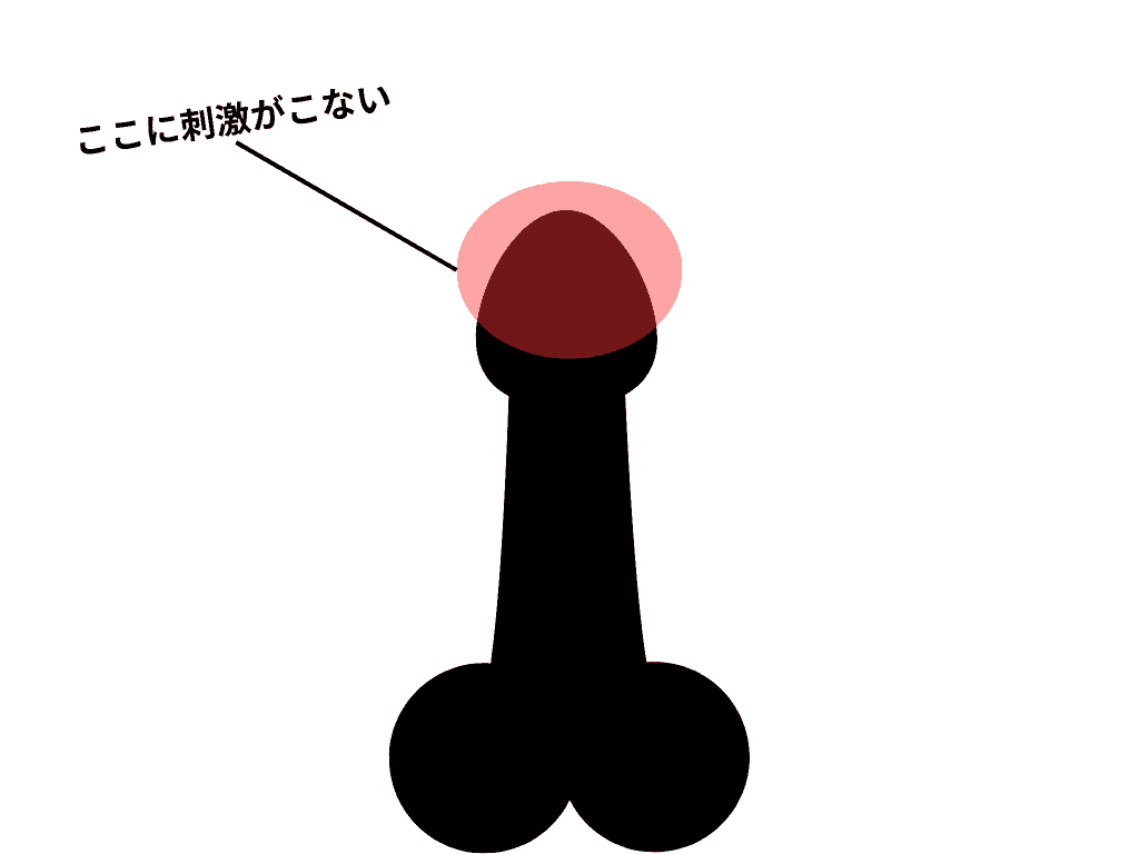 對龜頭上部的刺激很稀薄