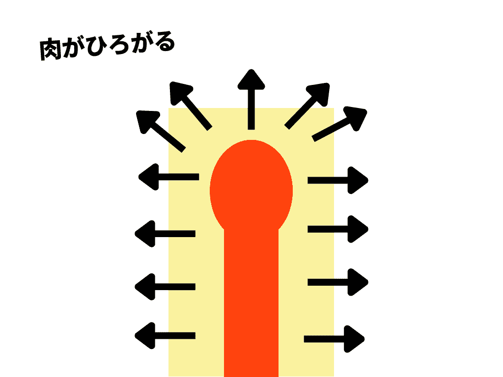 超軟系無法完全包夾的原因